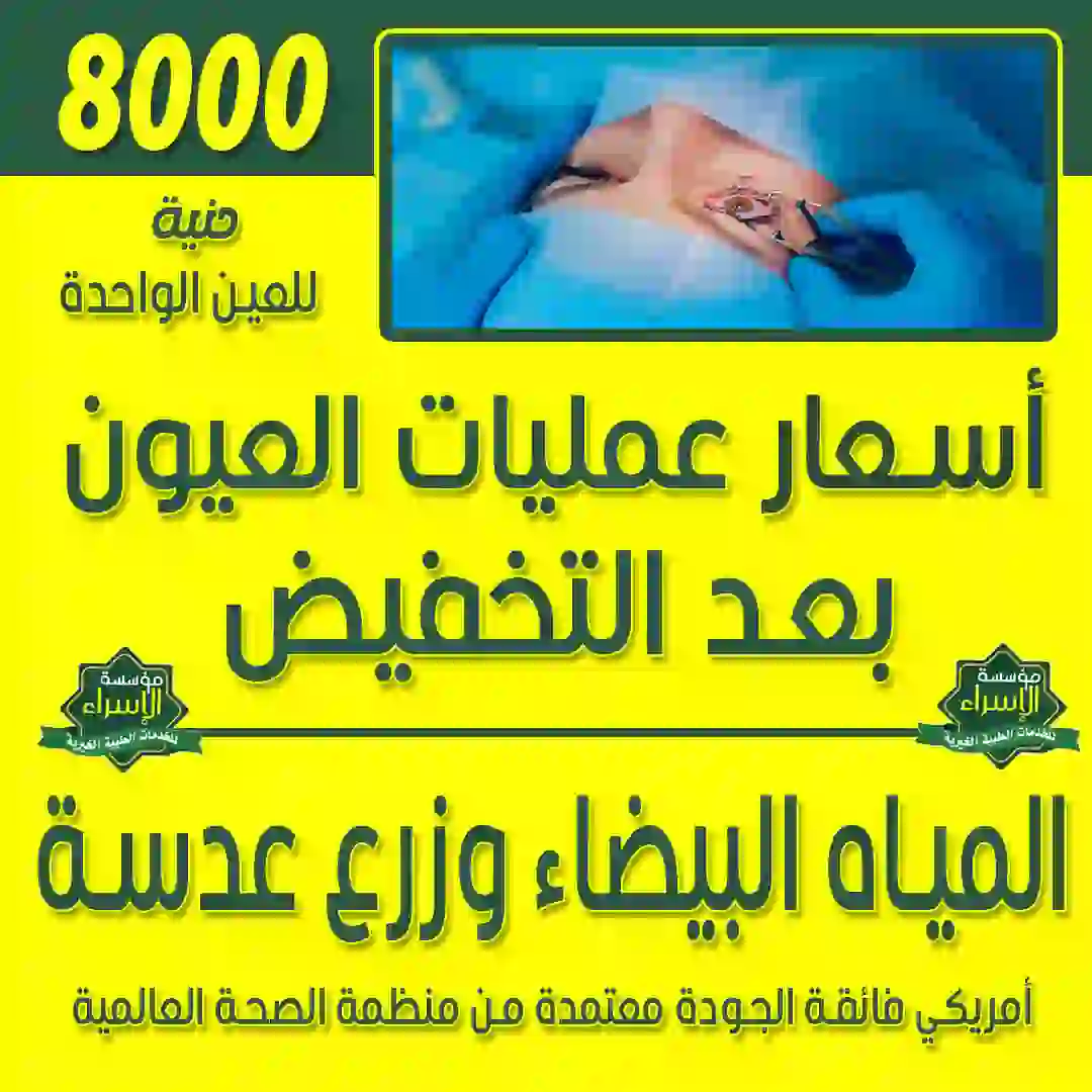 عملية المياه البيضاء وزرع عدسة أمريكي فائقة الجودة معتمدة من منظمة الصحة العالمية للعين الواحدة 8000 ج الكشف والفحوصات والتحاليل ومقاس العدسة والمتابعة اسبوعين 500 ج عملية المياه البيضاء وزرع عدسة أمريكي فائقة الجودة معتمدة من منظمة الصحة العالمية للعين الواحدة 8000 ج<br />
الكشف والفحوصات والتحاليل ومقاس العدسة والمتابعة اسبوعين 500 ج