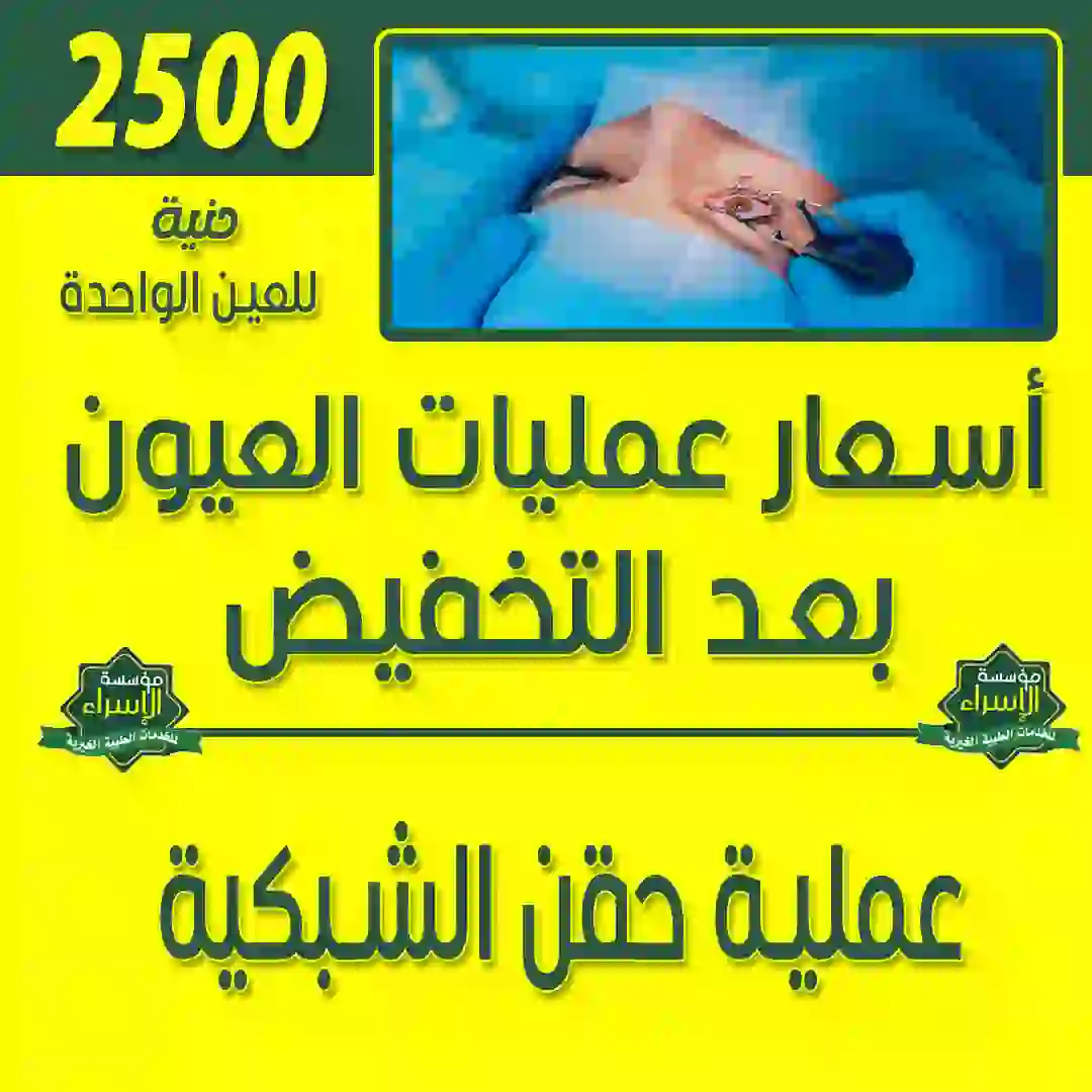 عملية حقن الشبكية عملية حقن الشبكية